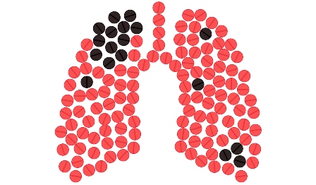 TB Status of Hyderabad District