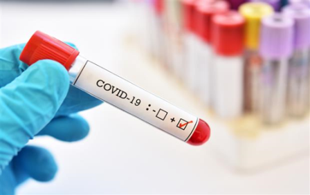 Bulletin on Novel Corona Virus (COVID-19) Date 12.05.2022